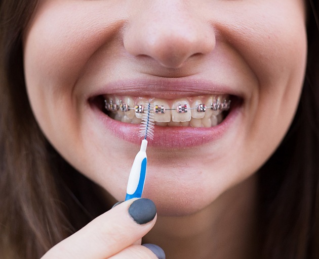 Girl cleaning her braces